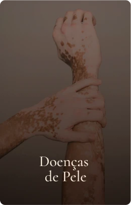 Doenças de Pele